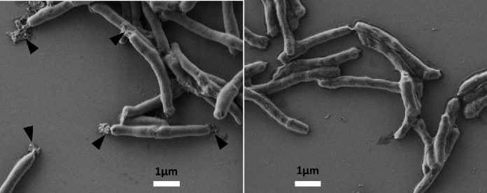 Tuberkulose: Klinische Erprobung eines neu entwickelten Medikaments