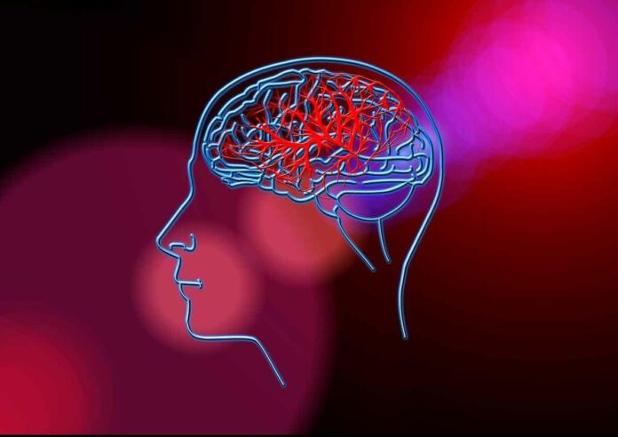 Schlaganfall - Forscher des LMU Klinikums schlagen neue Therapie vor